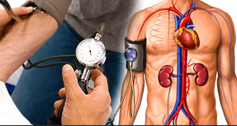Can Lupus Cause High Blood Pressure