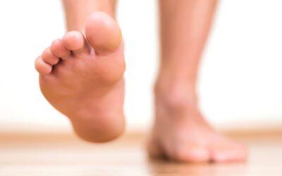 Does Lupus Affect Your Feet? Uncovering the Truth