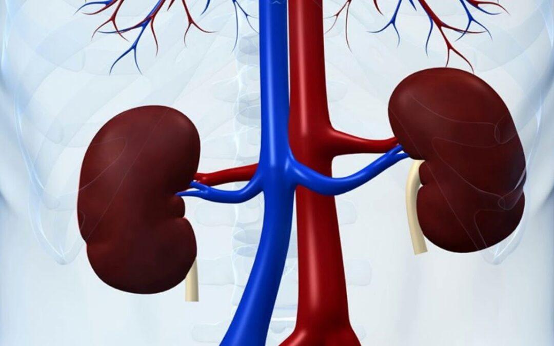 Does Lupus Go Away After Kidney Transplant