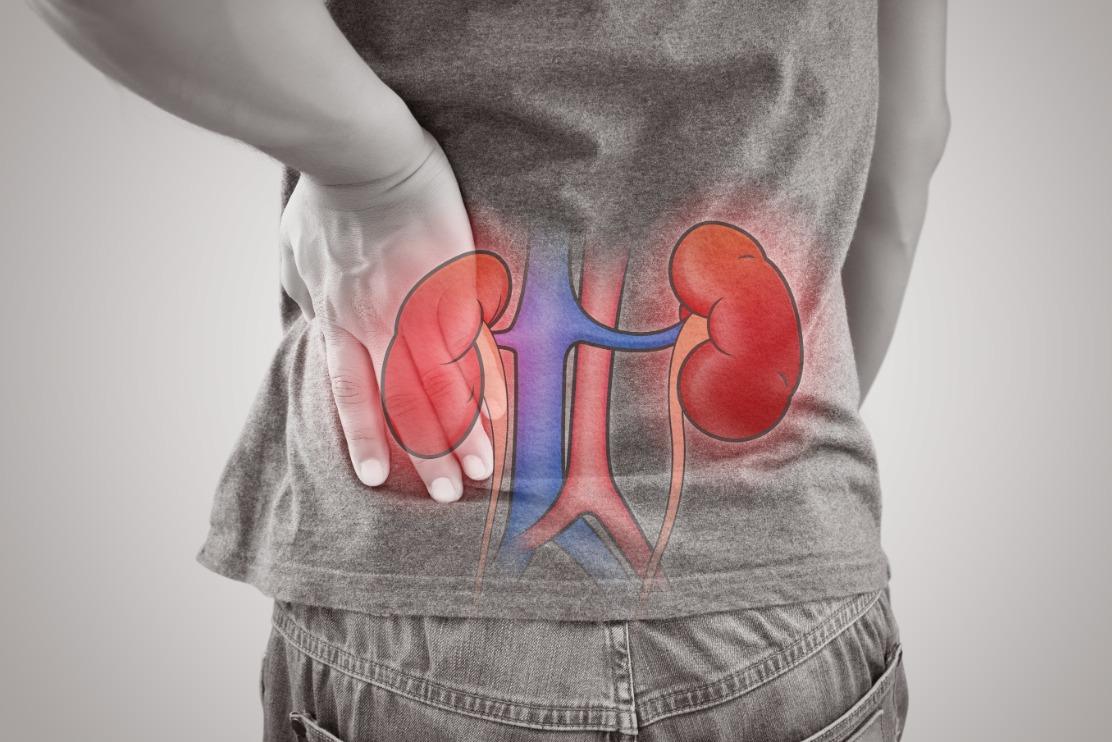 Dietary Recommendations for Optimal Kidney Health