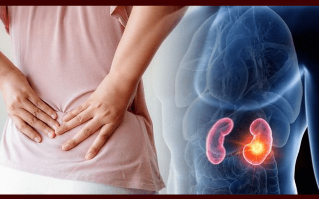 Natural Relief for Kidney Inflammation Diseases21