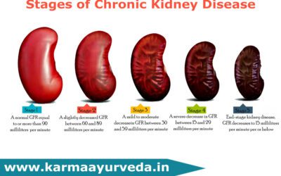 Is Chronic Kidney Disease Hereditary?