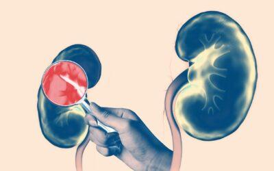 What Are the Most Common Kidney Diseases?