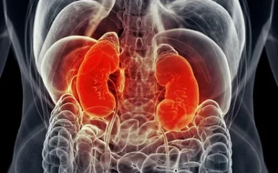 What would cause acute kidney injury?