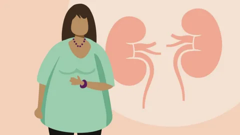 The link between obesity and kidney disease