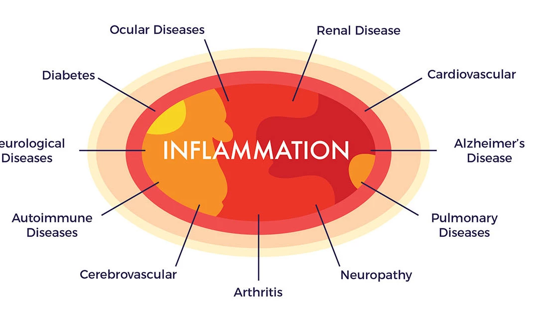 How to Overcome Inflammation in Diabetes?