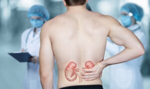 How to Check Kidney Health at Home